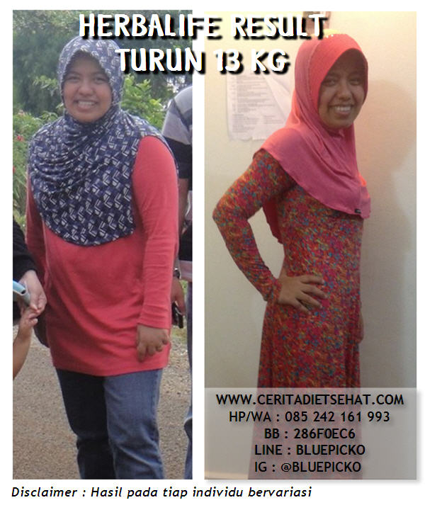 Before After Herbalife 01